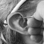 Auriculothérapie par TuinAlp