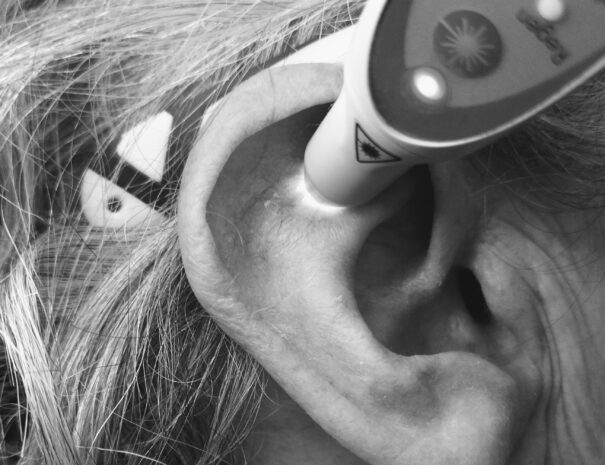 Réflexologie Auriculaire Traditionnelle Chinoise avec Laser pour traiter les addictions par Stéphane Rousseau TuinAlp à Crémieu